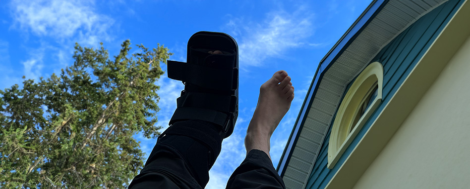 Hiking with a broken foot 